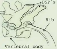 Kissing Spine Disease