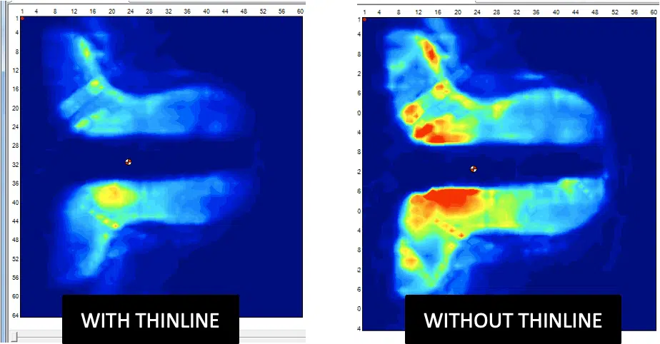 ThinLine Pressure Image